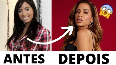 does anitta have a bbl|More.